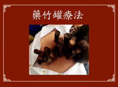 中药竹罐学习培训，技术加盟小本创业